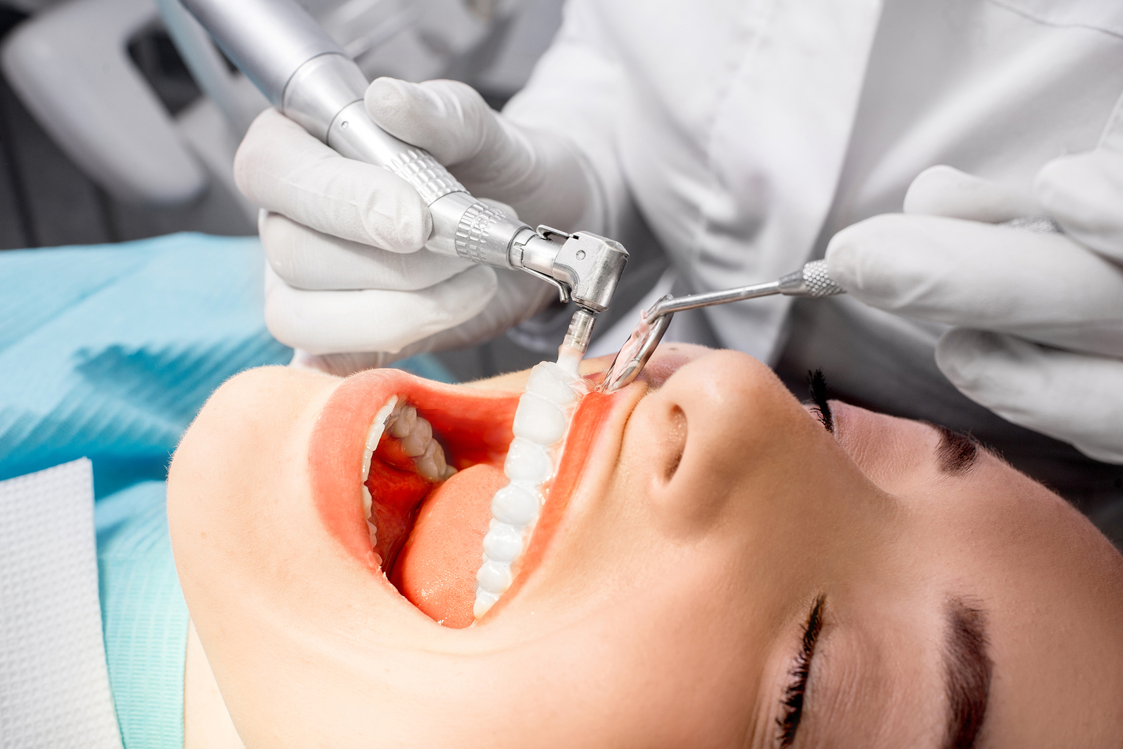 Comprehensive Guide to Dental Cleanings and Exams in Walnut Creek, CA